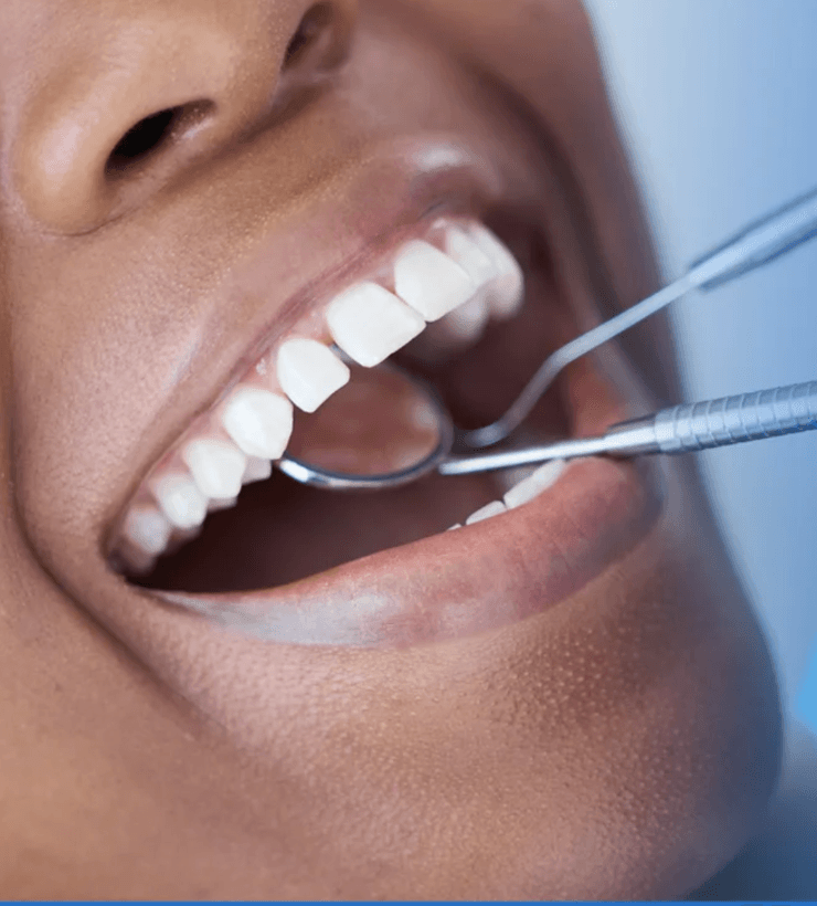 Dental examination — a healthy smile inspected with a mirror